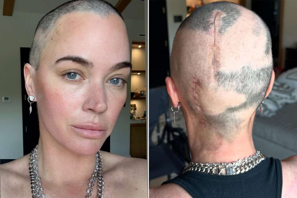 Teddi Mellencamp muestra sus cicatrices tras batalla contra el cáncer 2 teddi mellencamp cancer scars hair regrowth 042825 cf100f9594c340c497193492eb52c708