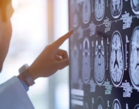 la falta sueno impacta areas especificas del cerebro.jpg